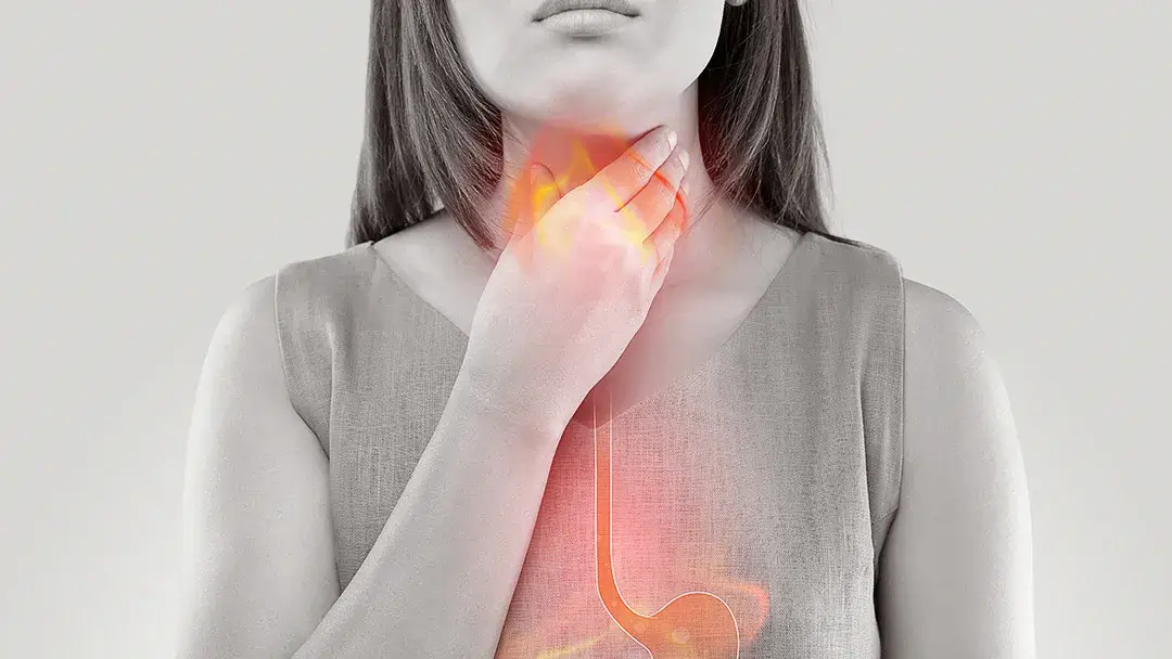 How To Get Rid of Heartburn