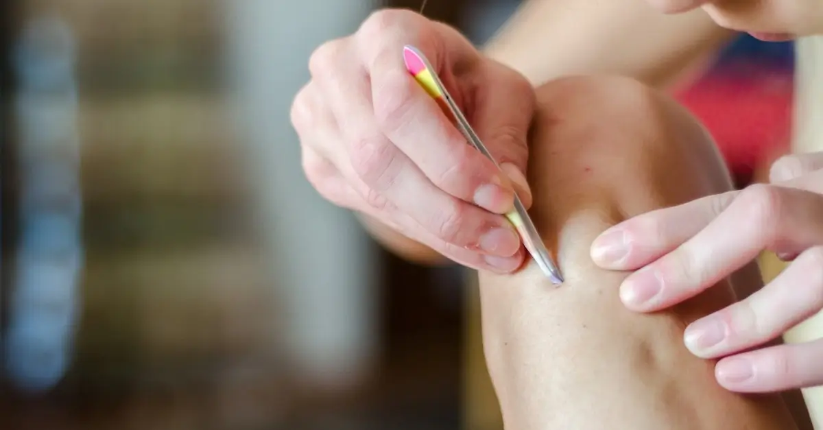 Home Remedies for Ingrown Hair