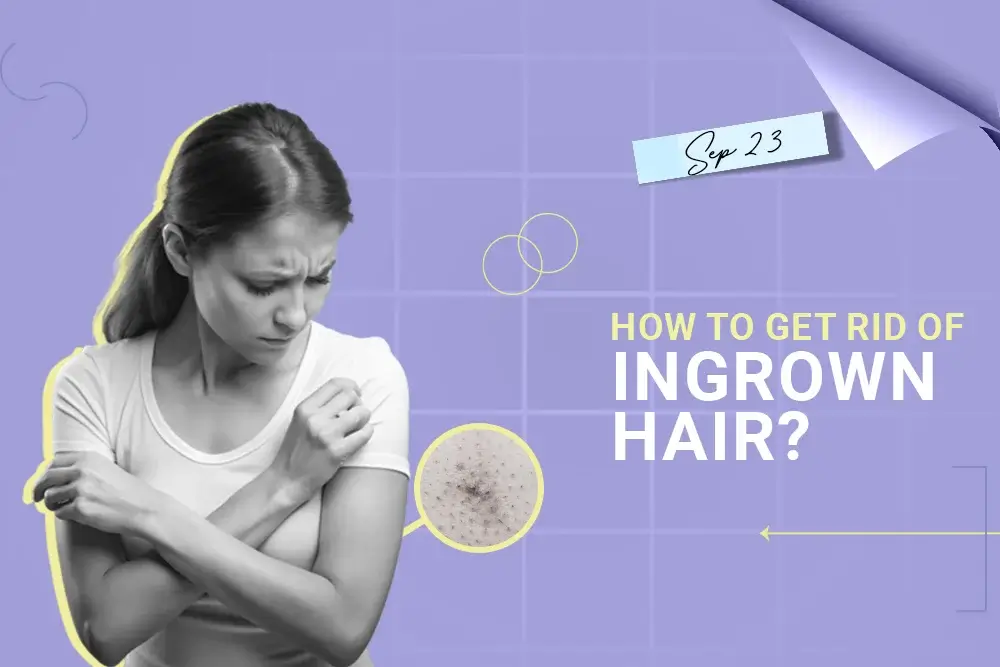 How To Get Rid Of Ingrown Hair