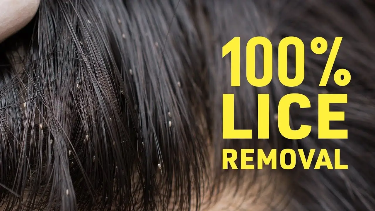 How To Get Rid Of Lice in Hair