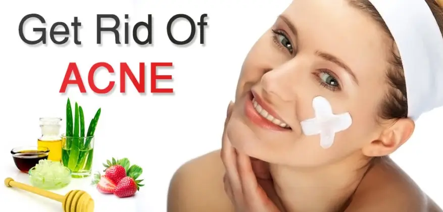 How To Get Rid of Acne