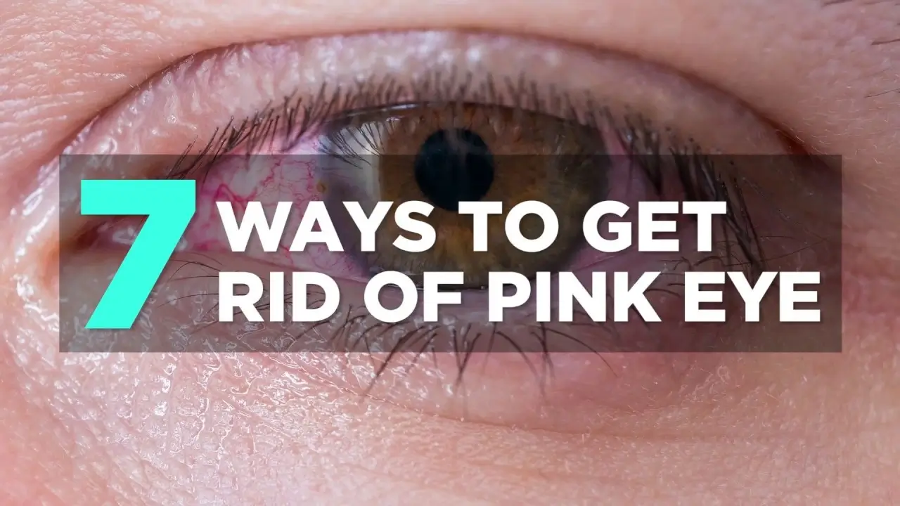 Get Rid Of Pink Eye
