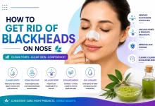 How To Get Rid Of Blackheads On Nose