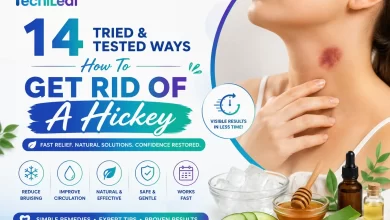 Ways How To Get Rid Of A Hickey