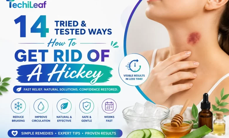 Ways How To Get Rid Of A Hickey