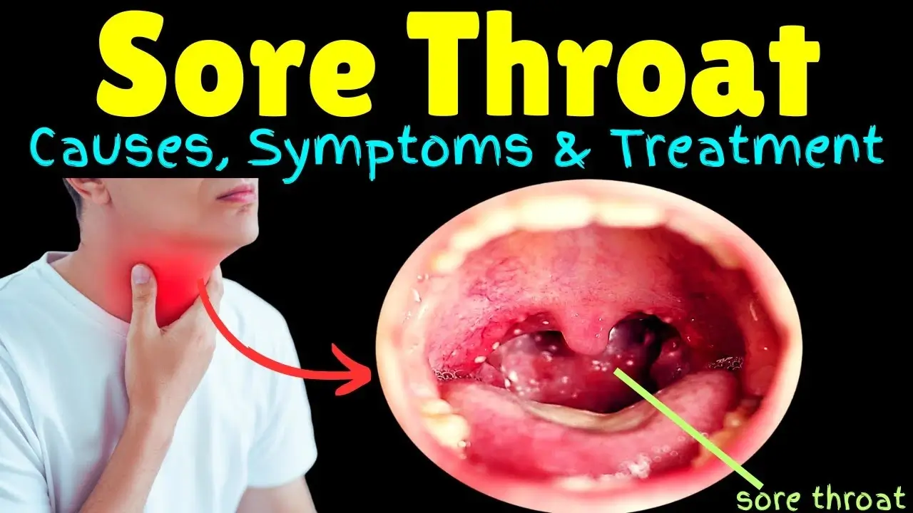 Get Rid Of A Sore Throat