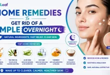 Home Remedies To Get Rid Of A Pimple Overnight