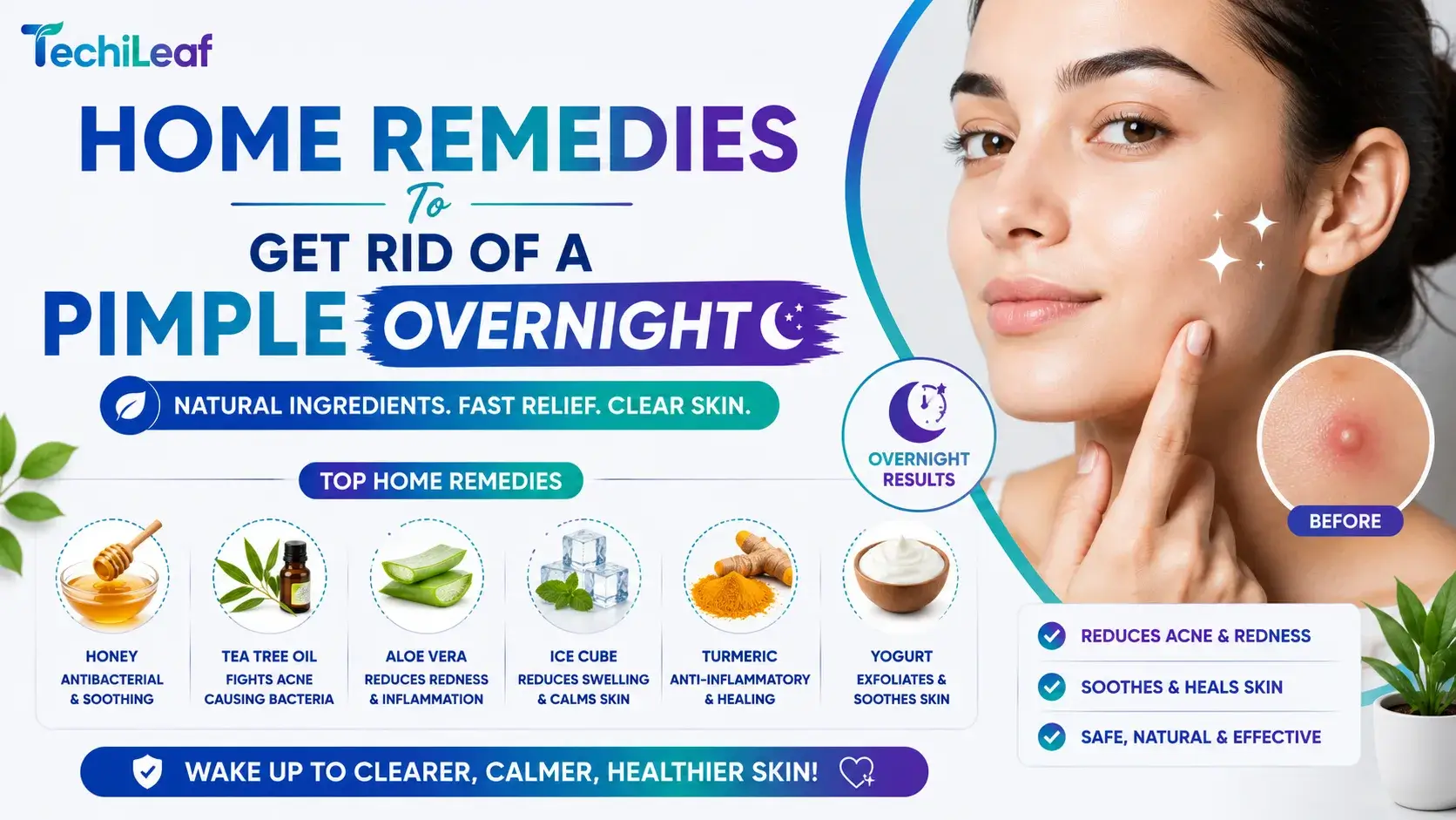 Home Remedies To Get Rid Of A Pimple Overnight