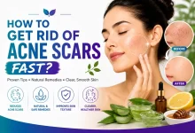 How To Get Rid Of Acne Scars Fast