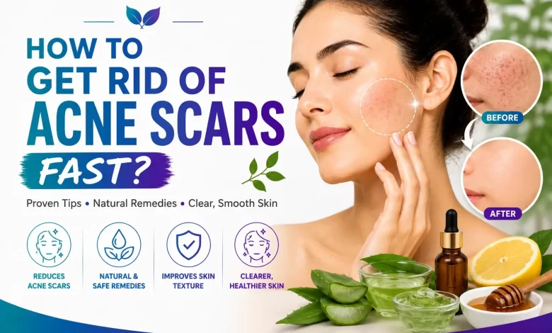 How To Get Rid Of Acne Scars Fast