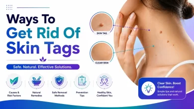 How to Get Rid Of Skin Tags