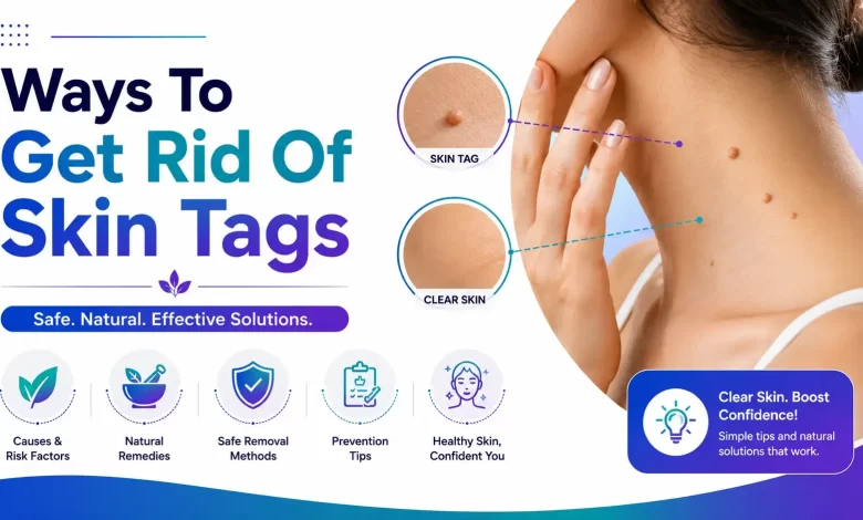 How to Get Rid Of Skin Tags