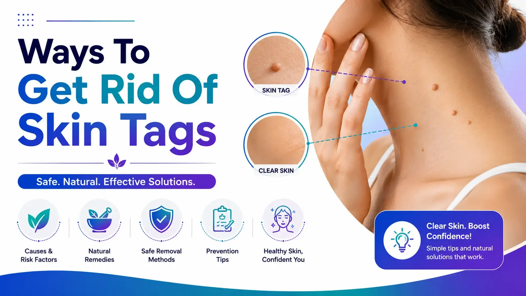 How to Get Rid Of Skin Tags