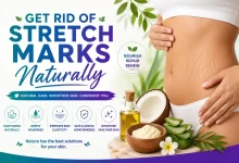 How to Get Rid Of Stretch Marks
