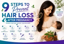 Steps To Prevent Hair Loss After Pregnancy