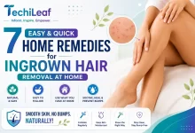 Top Home Remedies for Ingrown Hair