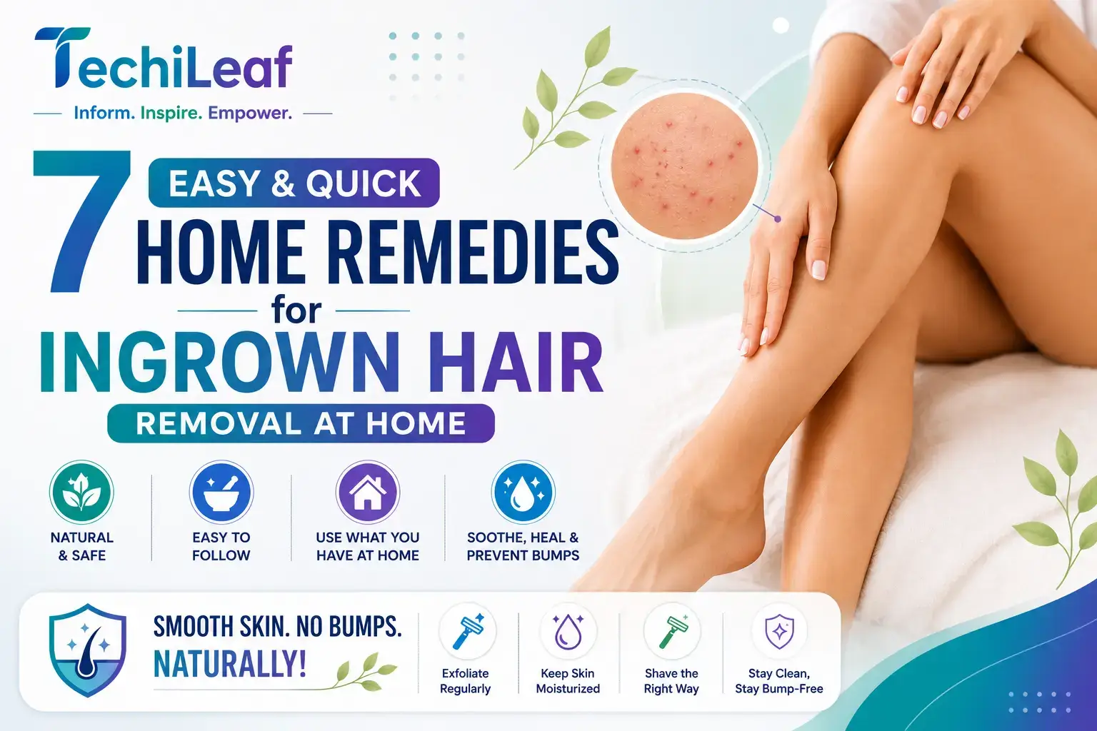 Top Home Remedies for Ingrown Hair