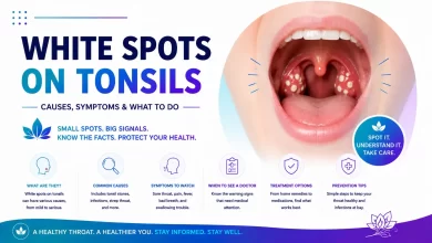 Causes and Symptoms of White Spots on Tonsils