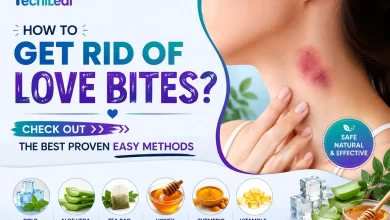 How To Get Rid Of Love Bites
