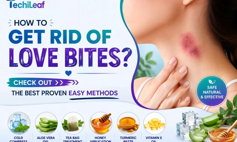 How To Get Rid Of Love Bites