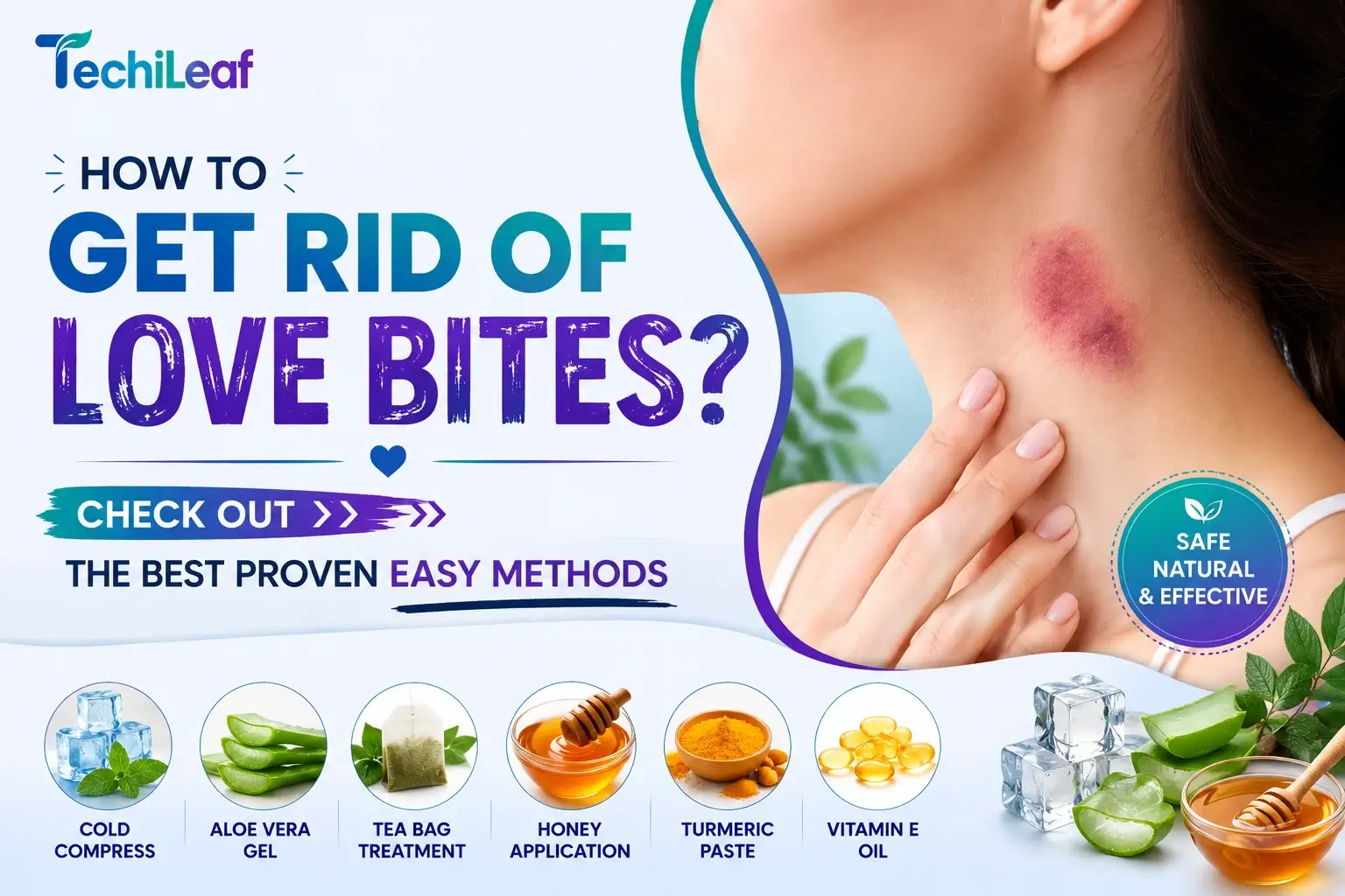 How To Get Rid Of Love Bites