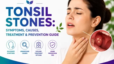 Tonsil Stones Symptoms, Causes, Treatment & Prevention