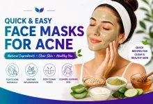 Easy Face Masks For Acne