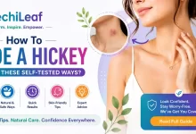 How To Hide A Hickey Using These Self-Tested Ways