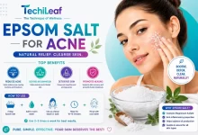 Epsom Salt for Acne To Treat Face Problems