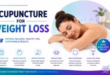 Acupuncture For Weight Loss