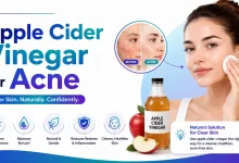 Apple Cider Vinegar for Acne