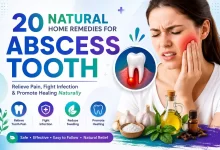 Home Remedies for Abscess Tooth