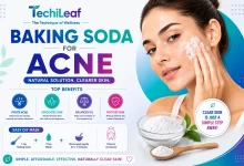 Baking Soda For Acne - Ultimate Beauty Guide