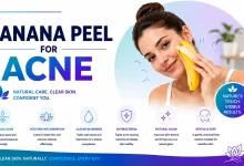 Banana Peel for Acne