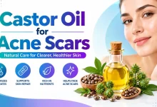 Castor Oil for Acne Scars