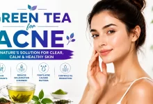 Green Tea for Acne Treatment
