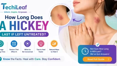 How Long Does A Hickey Last If Left Untreated