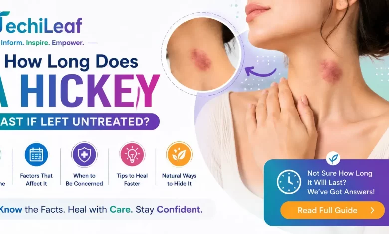 How Long Does A Hickey Last If Left Untreated