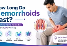 How Long Do Hemorrhoids Last and how to treat it