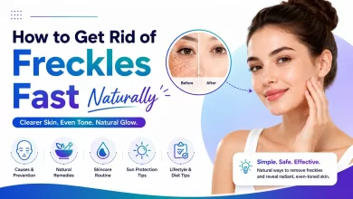 How to Get Rid of Freckles Fast