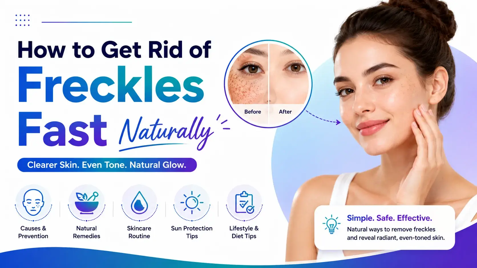 How to Get Rid of Freckles Fast