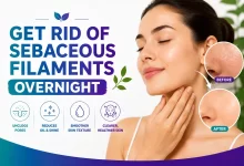 Get Rid of Sebaceous Filaments Overnight