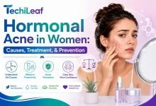 Reason behind hormonal acne in Women