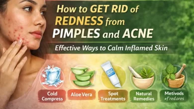 How to Get Rid of Redness from Pimples and Acne
