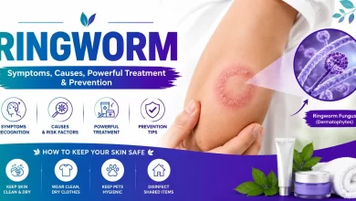Ringworm